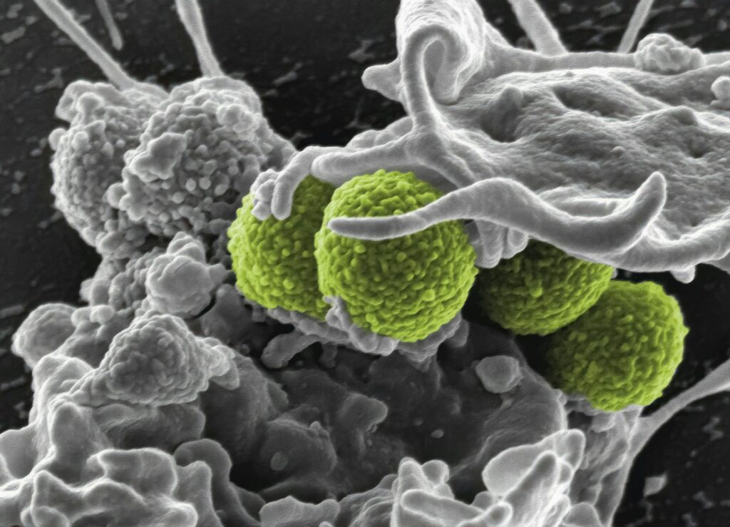 a close up of a green and white substance